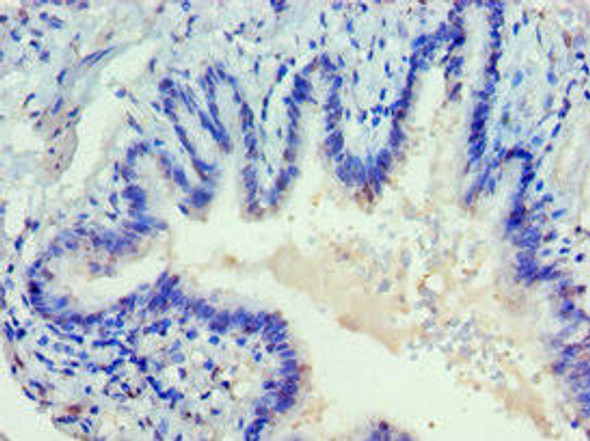 DVL2 Antibody (PACO43595)