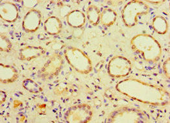 CHMP1B Antibody (PACO43707)