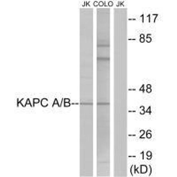 PRKACA Antibody (PACO21739)