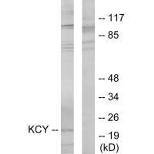 CMPK1 Antibody (PACO21767)