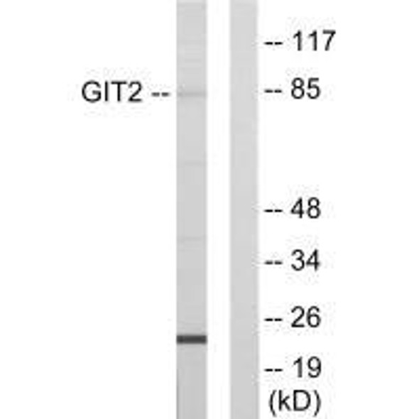 GIT2 Antibody (PACO21841)