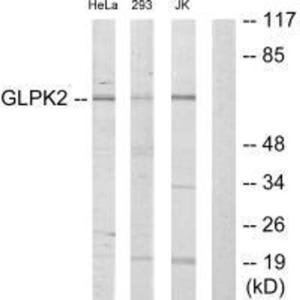 GK2 Antibody (PACO21846)
