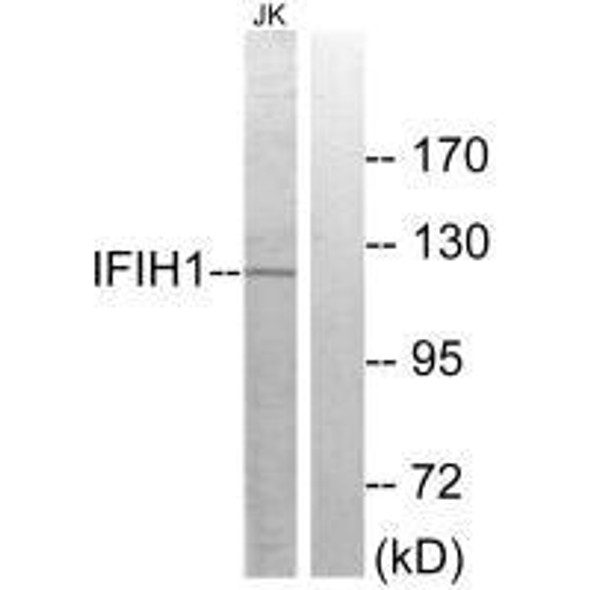 IFIH1 Antibody (PACO21945)