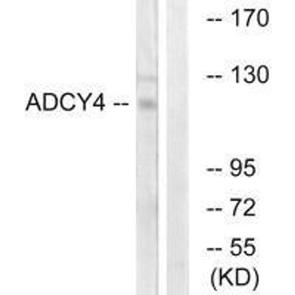 ADCY4 Antibody (PACO22009)