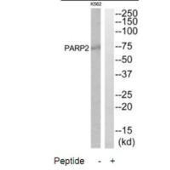 PARP2 Antibody (PACO22331)