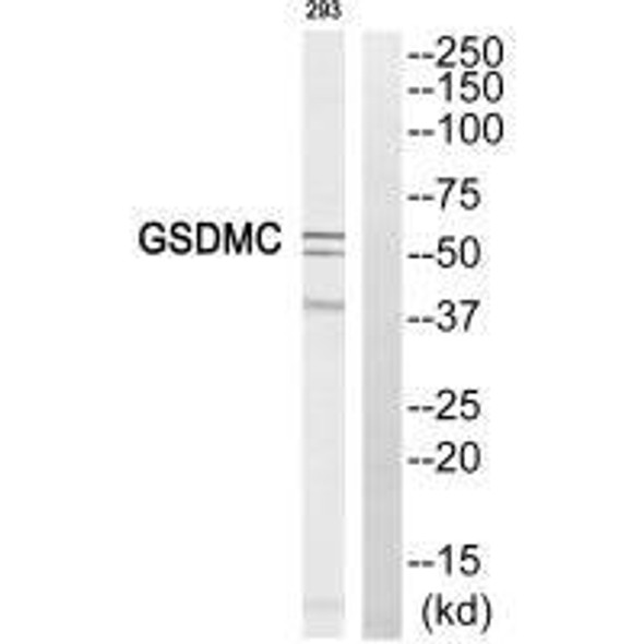 GSDMC Antibody (PACO22409)
