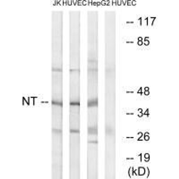 NTM Antibody (PACO22472)
