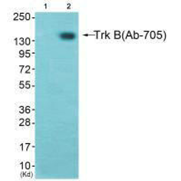 NTRK2 Antibody (PACO23024)