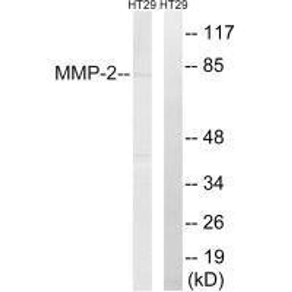 MMP2 Antibody (PACO23125)