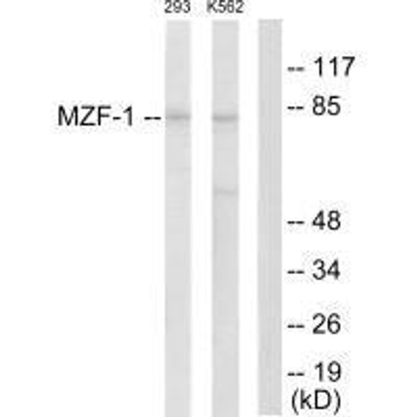 MZF1 Antibody (PACO23215)