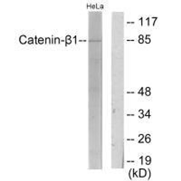 CTNNB1 Antibody (PACO23220)