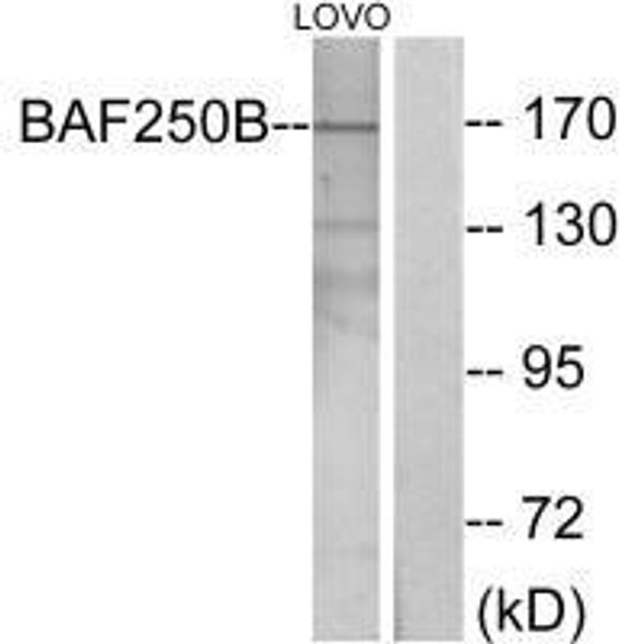 ARID1B Antibody (PACO23267)