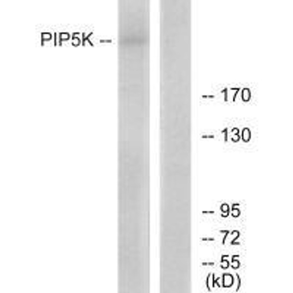 PIKFYVE Antibody (PACO23297)