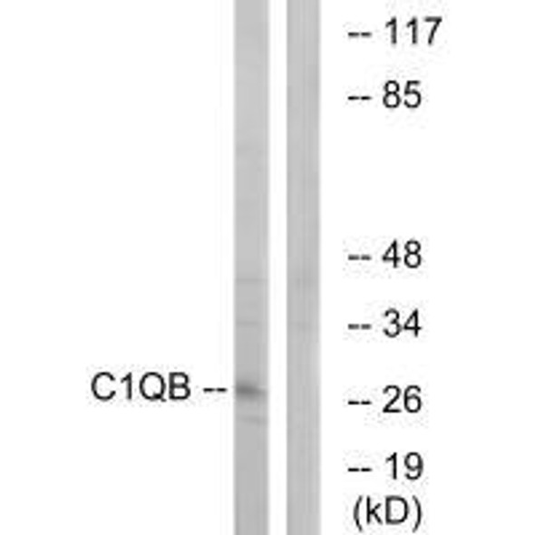 C1QB Antibody (PACO23420)