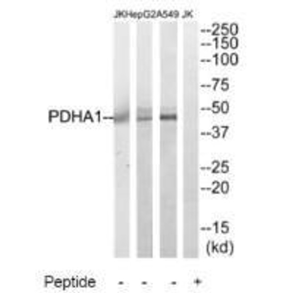 PDHA1 Antibody (PACO23469)