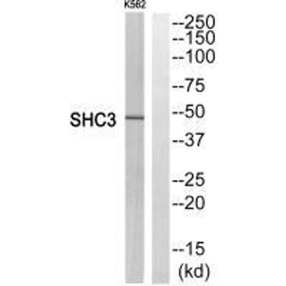 STMN1 Antibody (PACO23484)
