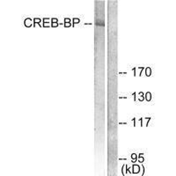CREBBP Antibody (PACO23645)