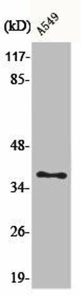 AKR1E2 Antibody (PACO00385)