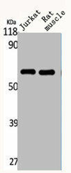 CYP4Z2P Antibody (PACO00672)