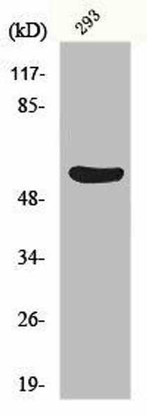 GSDMC Antibody (PACO00838)