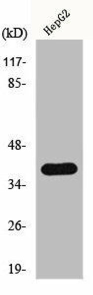 HNRNPC Antibody (PACO00923)