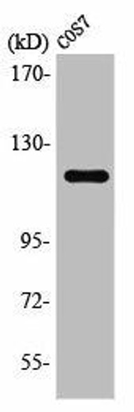 PTK2B Antibody (PACO01381)