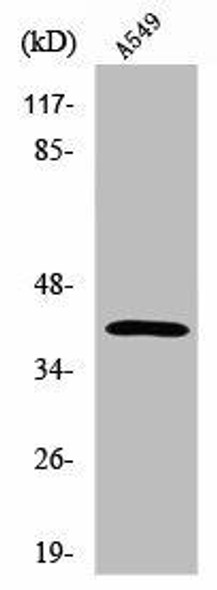 SGCB Antibody (PACO01472)