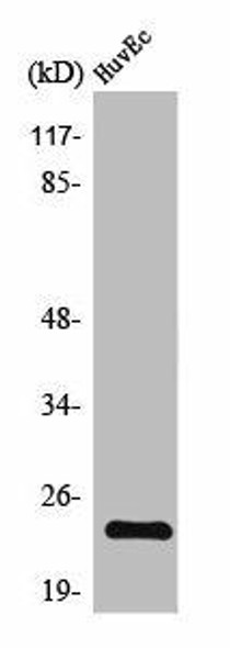 TNFAIP8 Antibody (PACO01639)