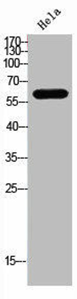 DCT Antibody (PACO01658)