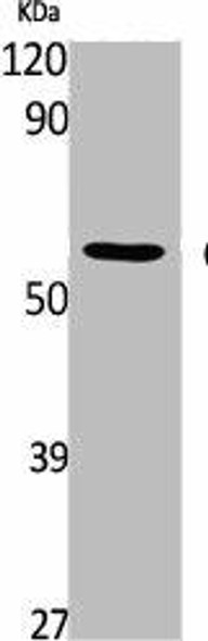 CAMK2D Antibody (PACO01782)