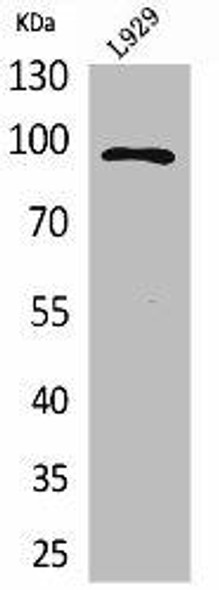 MACC1 Antibody (PACO01992)