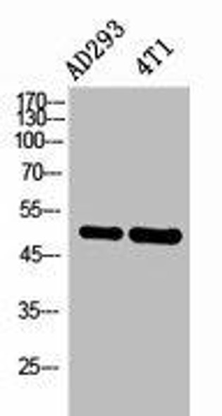 IL6R Antibody (PACO02212)