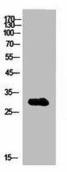 IGFBP1 Antibody (PACO02232)