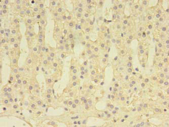 DENND1A Antibody (PACO38354)