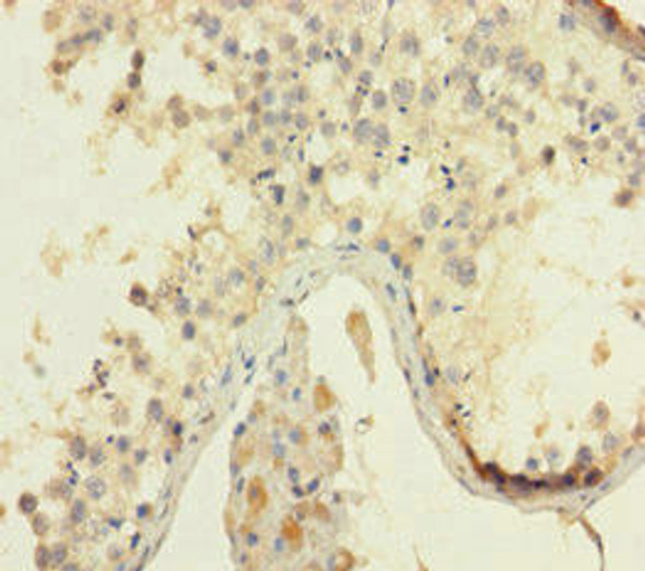HMGB4 Antibody (PACO39762)