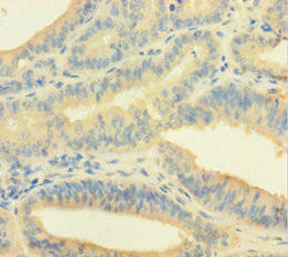 EME1 Antibody (PACO40086)