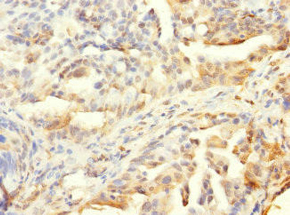 HCFC1R1 Antibody (PACO40674)