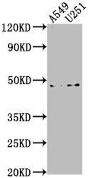 B4GALT6 Antibody (PACO63499)