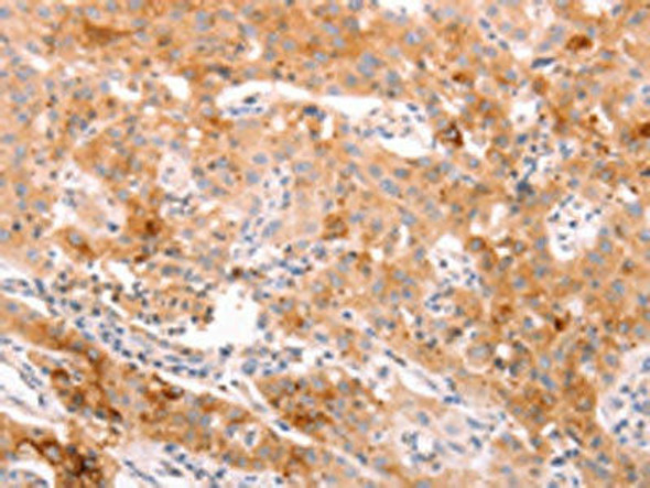 ALPPL2 Antibody (PACO18548)