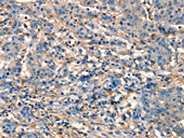 GJA8 Antibody (PACO18599)