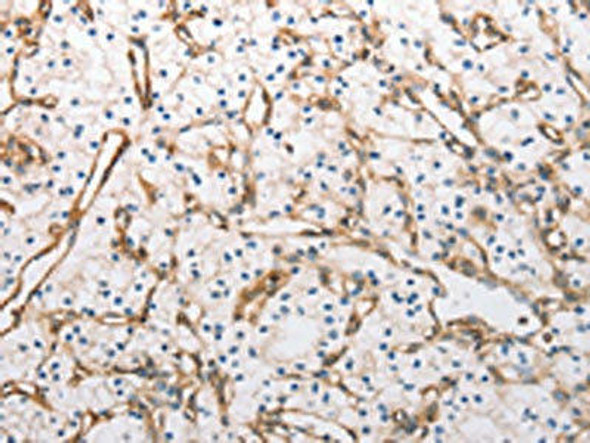 INA Antibody (PACO18745)