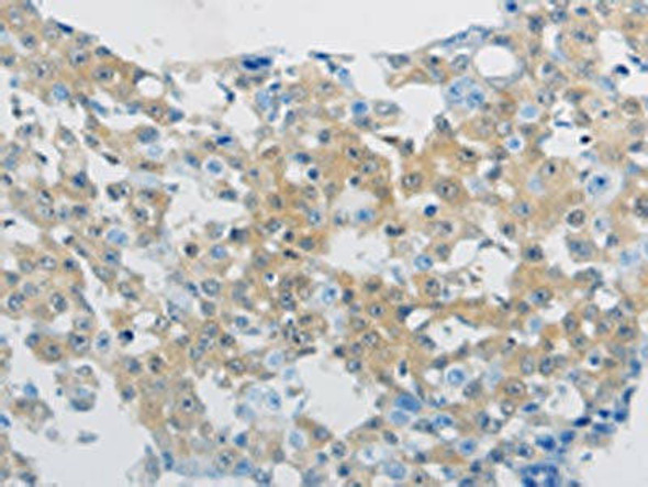 CLEC4C Antibody (PACO18782)