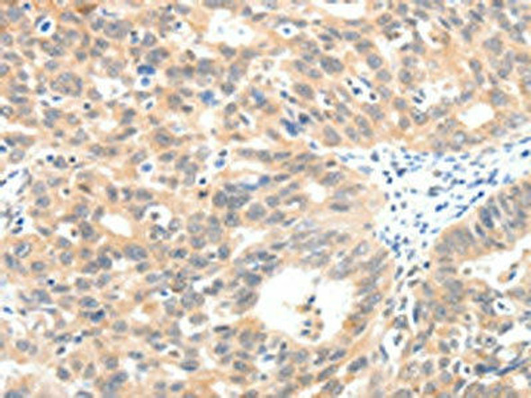 SCN2A Antibody (PACO18871)