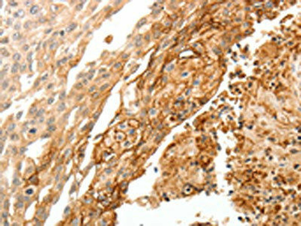 TGM1 Antibody (PACO18973)