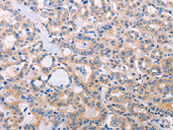 ADCY5 Antibody (PACO19064)