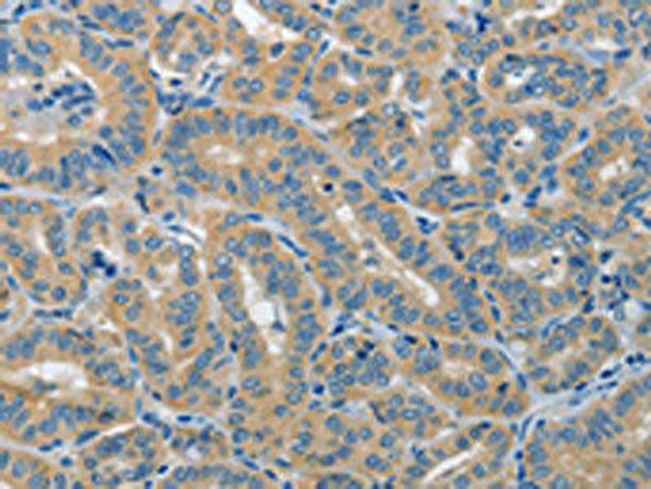 PIK3R4 Antibody (PACO19200)