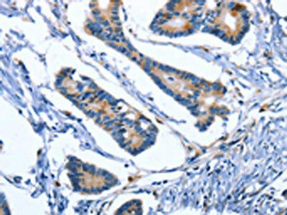 IBSP Antibody (PACO19360)