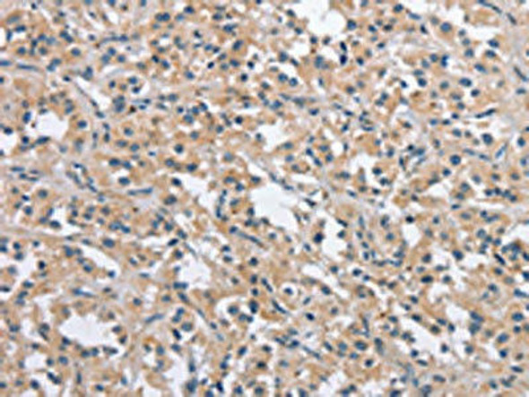 NLRP3 Antibody (PACO19520)