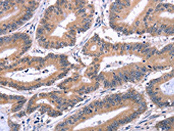 EFNA5 Antibody (PACO19607)