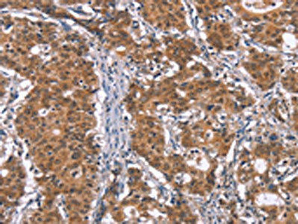 TUBGCP2 Antibody (PACO19699)